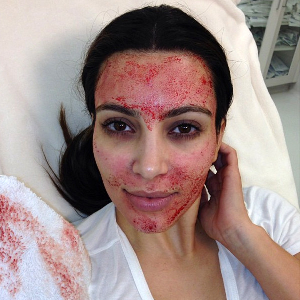 Vampire Facial, History of Skincare Vampire Facial, History of Skincare